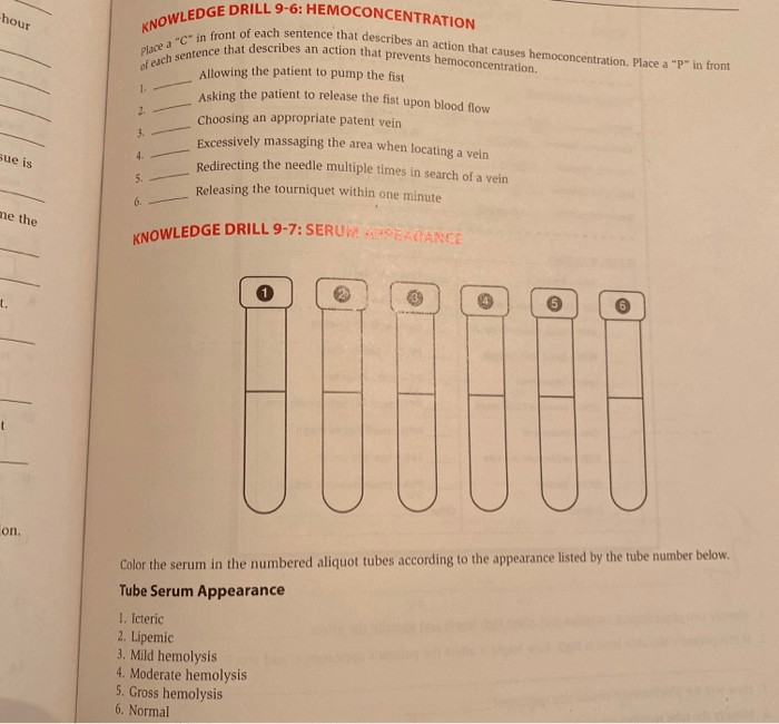 Knowledge drill 9-7 serum appearance