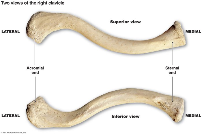 Horizontal bone spans from chest to shoulder